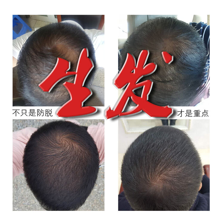 汉龙育发生发液套装洗护防脱控油熬制洗发水增发密发固发包-邮 汉龙