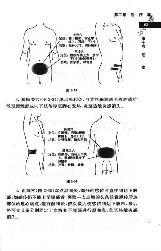 热敏灸实用读本