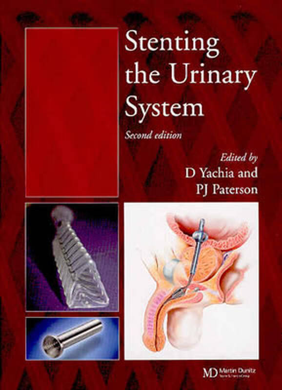 【预订】stenting the urinary system