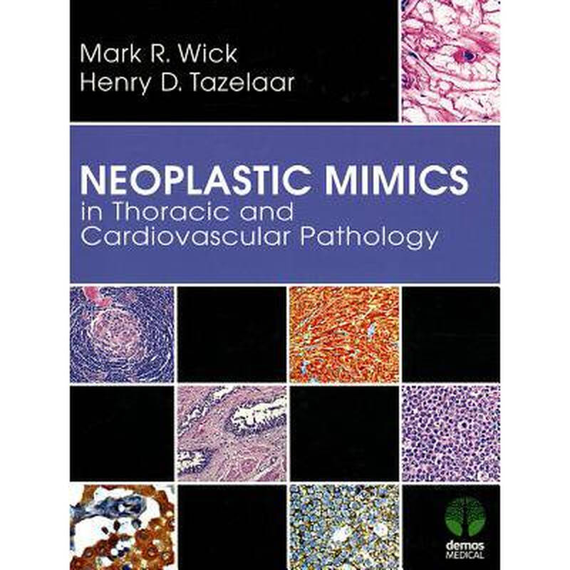 neoplastic mimics in thoracic and cardio.