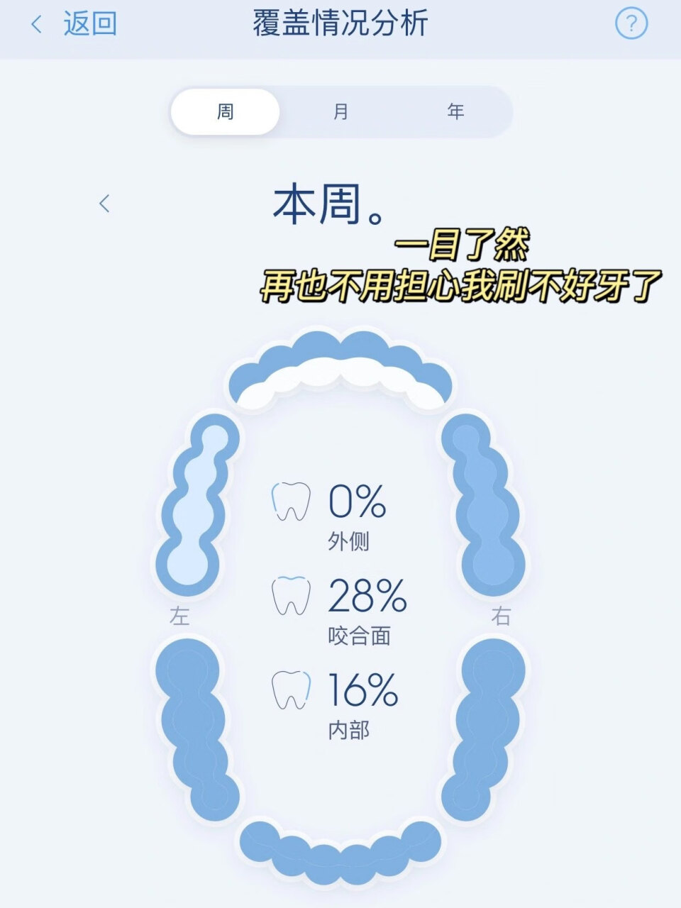 欧乐B电动牙刷成人 小圆头牙刷情侣礼物iO7云感刷 微震科技非声波(白色)【京品家电】,第9张