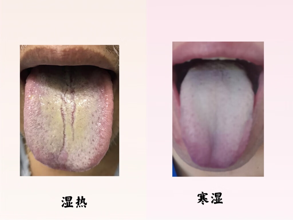 舌头的健康密码 - 知乎