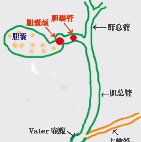 关于胰腺炎-京东健康