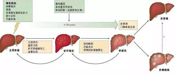 肝硬化的诊断和鉴别诊断