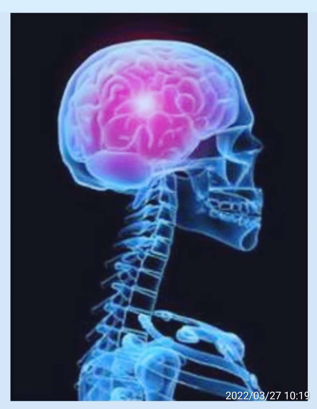 癫痫患者的脑深部电刺激DBS治疗 - 知乎