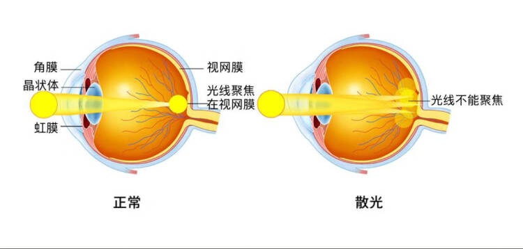 眼科巨头卷入“卖身”风波